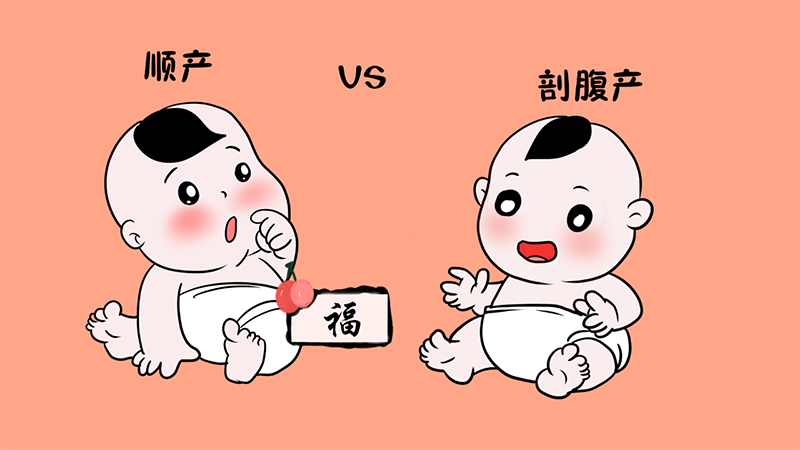 剖腹产